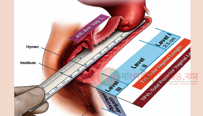 মহিলাদের যোনিপথের স্বাভাবিক দৈর্ঘ্য কত? চিকিৎসাবিজ্ঞানের ব্যাখ্যা ও স্বাস্থ্য সচেতনতা